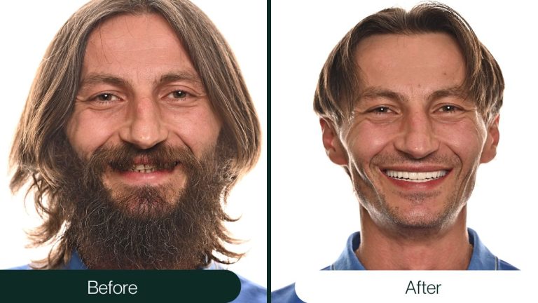 NTT Before After (11)