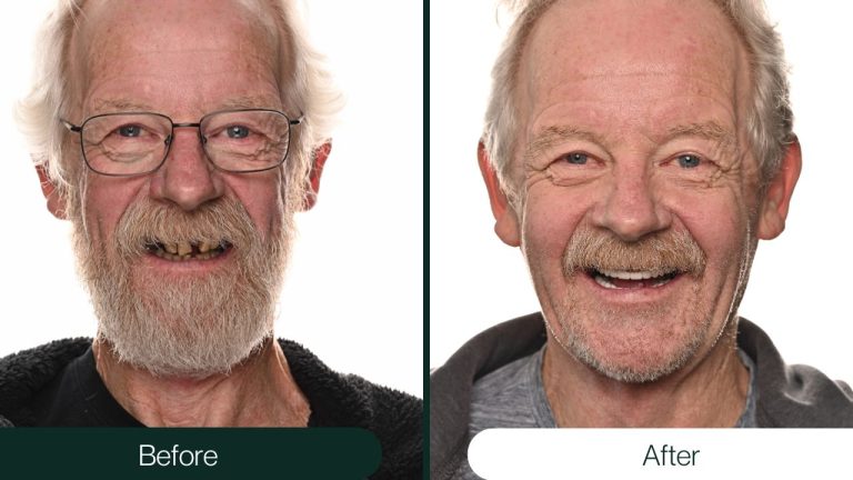NTT Before After (7)