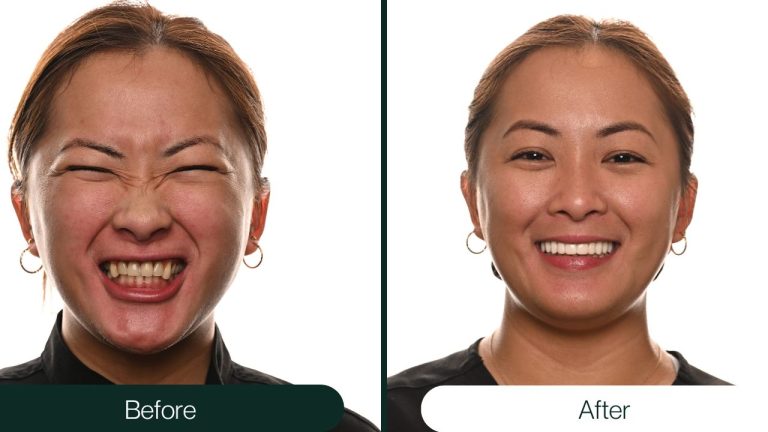 NTT Before After (8)